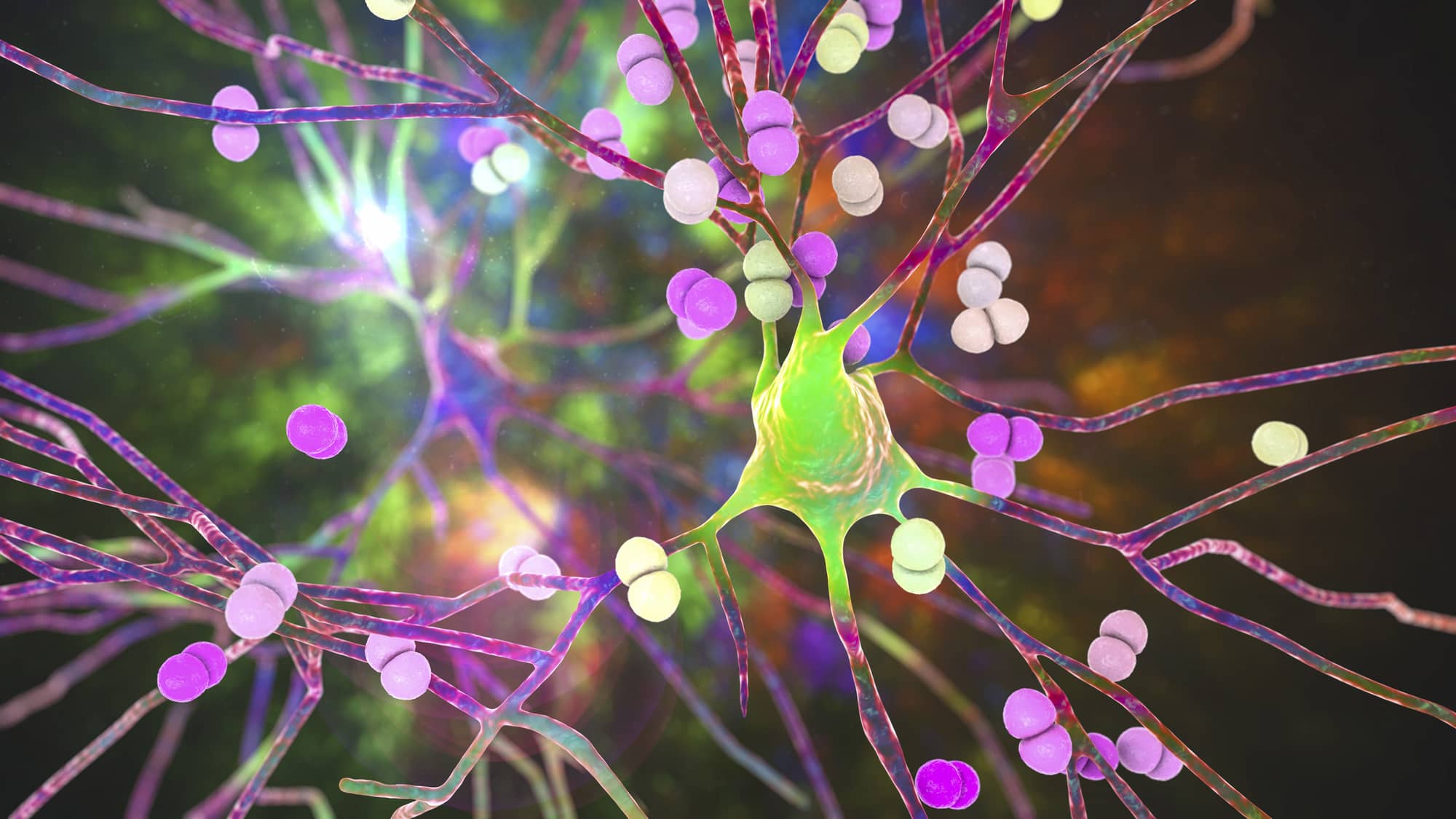 Bacteria infecting neurons stock photo